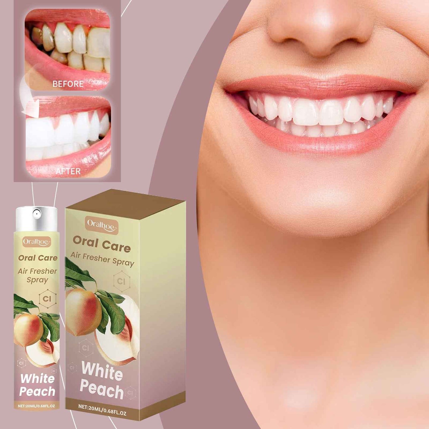 Oralhoe Oral Care Air Fresher Spray, Deep Clean Coffee Stain Whitening Teeth Fresh Breath Spray